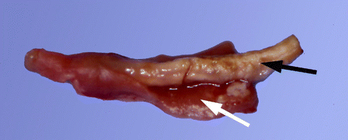 Figure 3.  Duck caeca, examined at 8 days p.i. with H. meleagridis. Note caseous core (black arrow) with haemorrhagic mucosa (white arrow).