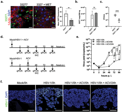 Figure 5.  The effect of antibacterial and antiviral agents. The antimicrobial activity of metronidazole (MET) in the 33277-treated OTG model was investigated. The OTG model was infected with bacteria in the presence (33277 + MET) or absence (33277) of MET. (a) Immunofluorescence staining using antibodies to P. gingivalis was performed to evaluate infection of the OTG model with the pathogen (P. gingivalis, green; nuclei, blue; scale bar 20 μm). Green fluorescence was quantified using ImageJ software and is presented as mean ± SD. **p < 0.01. (b) The level of bacterial DNA isolated from the OTG model was determined. Bars represent mean ± SEM. ns, not significant. (c) Additionally, cells were lysed at 24 h p.i. And plated on agar plates. Each point represents the number of CFU ± SD of at least two replicates. ****p < 0.0001. The effect of ACV was administered on the day of infection (HSV-1/0 h + ACV/0 h) or 24 h p.i. (HSV-1/0 h + ACV/24 h). (d) Schematic representation of the experiment. Both treatments with ACV efficiently reduce HSV-1 infection as indicated by qPCR (e). Each point represents mean ± SD. ****p < 0.0001. The observation was confirmed by immunostaining of HSV-1 (f, virus, green; nuclei, blue; scale bar, 100 μm).