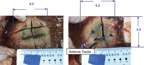 Figure 5. Triple synchronous, cooled antenna results, 5.2 cm (diameter) × 5.5 cm (diameter) × 6 cm (length) ablation in ex vivo bovine liver with three antennas at 915 MHz. (10 min, 45 W/antenna, cooled antennas). The left figure shows the insertion plane and the right figure shows the perpendicular plane. Spacing was 2.5 cm between antennas. With spacing pushed out to 3 cm (not shown) the dimensions of the volume are 5.3 cm (diameter) × 5.1 cm (diameter) × 5.1 cm (length), with some loss of volume when compared to the 2.5 cm spacing runs.