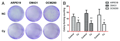 Figure 5. Cyclopamine treatment increased cell death and reduced colony-forming ability in uveal melanoma cells. (A) Clonogenic assays were used to measure the effects of cyclopamine on cell proliferation in UM and normal control cells. Cyclopamine inhibited the clonogenic survival of human UM cells. Experiments were repeated three times. (B) Surviving colonies were counted in five random visual fields. Data represent the mean ± SD of three determinations (*P < 0.05; **P < 0.01).