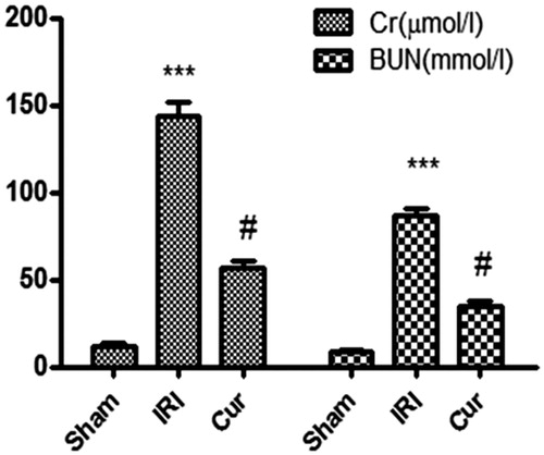 Figure 1. Effects of Curcumin pretreatment on renal function following renal I/R-induced injury. Serum creatinine and BUN were measured to assess the reno-protective effect of Cur against renal I/R. Data are represented as mean ± SEM (n = 10). ***p < .001 (IRI vs. Sham); #p < .005 (IRI vs. Cur).