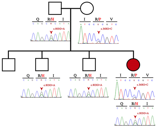 Figure 3 Pedigree information of the patient and Sanger sequencing electropherogram of both patient and her family.