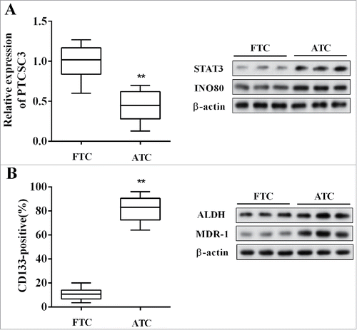 Figure 1. LncRNA PTCSC3 was low-expressed in ATC tissues. (A) The expression of PTCSC3 in FTC (n = 20) and ATC tissues (n = 20) was quantified by qRT-PCR. **P < 0.01 vs. FTC; the expression of proteins was analyzed by western blot. (B) The positive expression rate of CD133 was analyzed by flow cytometry. **P < 0.01 vs. FTC; the levels of ALDH and MDR-1 were analyzed by western blot.