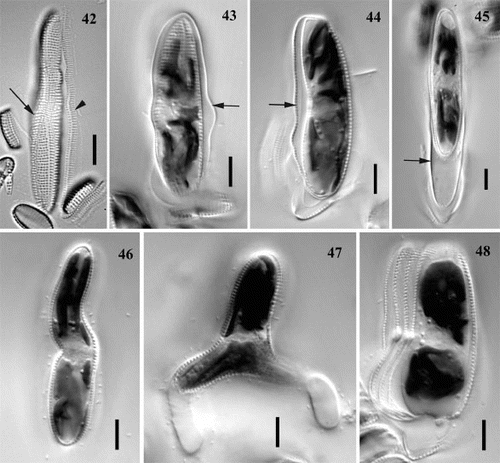 Figs 42 – 48. Perizonium, initial cells and abnormalities of auxosporulation in Achnanthes cf. subsessilis, clone C. Fig. 42. Longitudinal perizonium: central (arrow) and lateral (arrowhead) bands. Figs 43 – 45. Initial cell associated with the perizonium (arrow) and the frustule of parental cell: valve view (Fig. 43), girdle view (Fig. 44), and initial cell escaping from the perizonium (Fig. 45). Figs 46, 47. Initial cells of abnormal shape: sigmoid (Fig. 46) and triradiate (Fig. 47). Fig. 48. Multiple deposition of hypothecae during initial cell formation. Scale bars represent 10 μm.