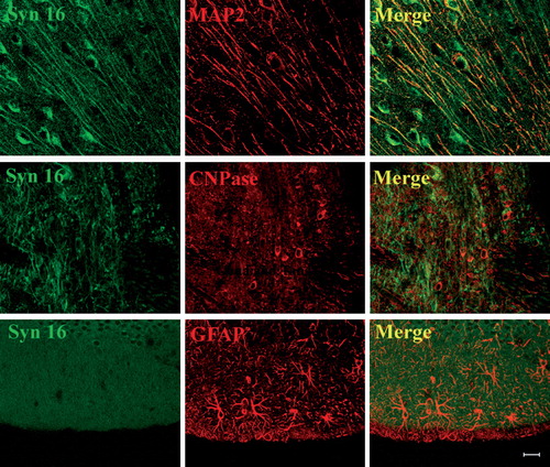 Figure 2.  Expression of Syn 16 in different brain cell types. 30 µm cryosections of adult mouse brain were double-labeled with rabbit antibody against Syn 16 (FITC, green) and mouse monoclonal antibodies against neuronal (dendritic) marker MAP-2 (upper panel), the oligodendrocyte marker CNPase (middle panel) and the astrocyte marker GFAP (lower panel) (Texas Red, red). Scale bar = 20 µm.