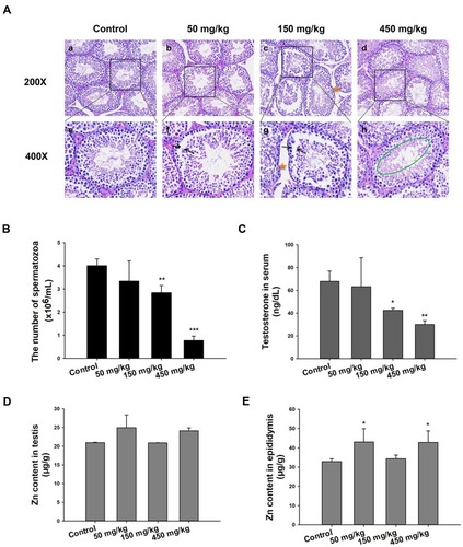 Figure 2 Histopathology, sperm count, testosterone levels, and AAS for Zn. (A) Light microscopy of cross-sections of H&E stained testes from male mice. Arrow indicates a lesion in seminiferous tubule; pentastar indicates the vacuolization of Sertoli cells; green circle indicates disorder in germ cell. (B) Sperm count in the left epididymis. The data in sperm per milliliter of saline. (C) Testosterone concentration in serum detected by ELISA. (D) and (E) Concentration of Zn in testes and epididymis. Data are expressed as mean ± SD, *P<0.05, **P<0.01, ***P<0.001 compared with control.