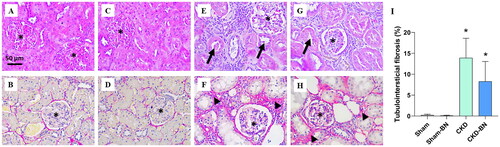 Figure 1. Representative photomicrographs [a–h] and fibrosis quantification [I] of renal tissue of experimental groups. Sham [a, b] and Sham-BN [a, d] groups show preserved parenchyma and no fibrosis. In contrast, CKD [e, f] and CKD-BN [g, h] groups presented dilated tubules (indicated by arrows), and several regions with fibrosis (indicated by arrowhead). Hematoxylin and eosin [a, c, e, g] and Picrosirius [b, d, f, h], 40x magnification. (*) means statistical difference compared to the Sham group (p = 0.0095). Statistical significance was considered when p < 0.05. One-way ANOVA with Sidak post-test. [i] Sham, n = 5; Sham-BN, n = 5; CKD: n = 5; CKD-BN: n = 5.