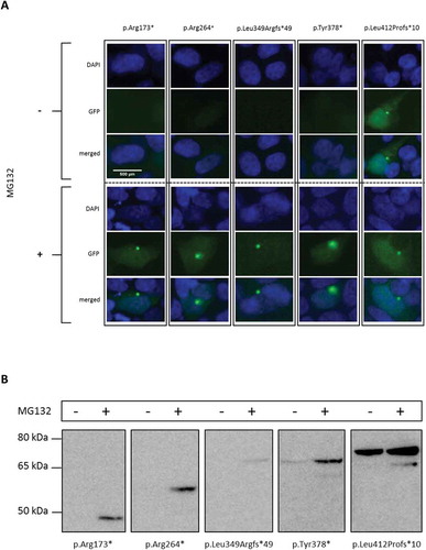 Figure 3. Degradation of N-terminal mutated ADNP.HEK293T cells were transiently transfected with expression vector encoding GFP-tagged hADNP and where indicated treated with the proteasome inhibitor MG132 (200 nM). (a) ICC of HEK293T cells transfected with a vector expressing distinct N-terminal mutant hADNP transcripts. ADNP is shown in green (GFP), the cell nucleus in blue (DAPI). A gradient of no to little GFP-signal, indicative for ADNP expression is observed in untreated conditions. After treatment of the transfected cells with proteasome inhibitor MG132, ADNP expression is visible in confined spots in the cytoplasm. (b) Western blot analysis of the N-terminal truncated ADNP proteins. Cells were lysed in RIPA buffer and analyzed by immunoblotting for ADNP with anti-GFP antibody. Total protein normalization by means of Ponceau S was used for cell loading control. The predicted molecular mass for the transcripts are the following: p.Arg173* at 47 kDa, pArg264* at 57 kDa, p.Leu349Argfs*49 at 72 kDa, p.Tyr378* at 69 kDa and p.Leu412Profs*10 at 74 kDa. Only after treatment with MG132 are transcripts detectable or increased in expression. One representative experiment out of 2 is shown here.