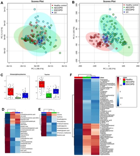 Figure 1 Dysregulated metabolites revealed by metabolomics. (A and B) Principle component analysis score plots of all sample groups in positive (A) and negative ion mode (B). Groups are presented in different colors (AECOPD, green; SSCOPD (Stable COPD), blue; healthy control, red; QC, dark blue). (C) Grouped scatter plots presenting levels of glutamylphenylalanine and taurine. (D) Heat map presenting metabolites that are only dysregulated in AECOPD. (E) Heat map presenting metabolites that are only dysregulated in SSCOPD (Stable COPD). (F) Heat map presenting metabolites that are only dysregulated in the Healthy control.