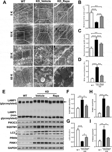 Figure 5. Rapamycin mitigates autophagic vacuoles and restores mitophagy in the heart of TAFAZZIN KD mice. (A) Electron microscopy analysis of cardiac mitochondrial morphology in the WT and TAFAZZIN KD mice fed with control or rapamycin diet. Scale bar: 4 μm. Arrows highlight the mitochondria with vacuole. S, sarcomere. (B) Quantitative analysis of cardiac mitochondrial size. n = 3 mice per group, and 100 mitochondria per mouse were counted. (C) Statistical analysis of sarcomere width in the heart of WT and TAFAZZIN KD mice fed with control or rapamycin diet. (D) Quantitative analysis of autophagic vacuoles in the heart of WT and TAFAZZIN KD mice fed with control or rapamycin diet. n = 3 mice per group, and 100 mitochondria per mouse were counted. (E) Western blot analysis of LAMP1 and biomarkers associated with autophagy and mitophagy, including PIK3C3, LC3, SQSTM1, PINK1 and PRKN, in the heart of WT and TAFAZZIN KD mice fed with control or rapamycin diet. (F-I) Statistical analysis of protein expression levels, including SQSTM1 (F), LC3-II:LC3-I ratio (G), PINK1 (H), and PRKN (I), in the heart of WT and TAFAZZIN KD mice fed with control or rapamycin diet. n = 4. Data are represented as mean ± SD. *p < 0.05, **p < 0.01, ***p < 0.001 by one-way ANOVA.