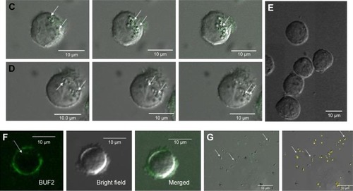 Figure 2 (A) Cytotoxicity of BUF2-magnetite conjugates as tested by LDH assays after 24 and 72 hours. Cell viability remained above 95% for all studied concentrations. (B) Assessment of the hemolytic effect of BUF2-magnetite conjugates at different concentrations. Data points are mean data of each concentration. In all cases, hemolysis was below 5%. (C) Confocal microscopic images of effective cellular internalization (THP-1 cells) of BUF2-FITC-magnetite as prepared by conjugation via glutaraldehyde (arrow in inset). Scale bar corresponds to 10 μm. (D) Confocal microscopic images of effective cellular internalization (THP-1 cells) of BUF2-FITC-magnetite as prepared by conjugation via EDC (arrow in inset). Scale bar corresponds to 10 μm. (E) Confocal microscopic image showing failed internalization of fluorescently labeled bare magnetite (negative control). (F) Confocal microscopic images of effective cellular internalization of BUF2-FITC (arrow in inset). Scale bar corresponds to 10 μm. (G) Confocal microscopic images of internalization of BUF2-FITC into E. coli (arrow in inset). The image on the right shows the threshold mask to BUF2-FITC to remove the fluorescence background. Scale bar corresponds to 10 μm.Abbreviations: BUF2, buforin II; LDH, lactate dehydrogenase; EDC, N-[3-(dimethylamino)-propyl]-N′-ethylcarbodiimide hydrochloride; FITC, fluorescein isothiocyanate; E. coli, Escherichia coli.