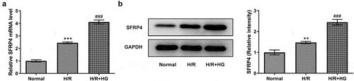 Figure 1. SFRP4 expression is upregulated in a high-glucose-stimulated H/R cardiomyocyte model. (a-b). Detection of SFRP4 expression was performed using RT-qPCR and Western blotting. Results are the mean ± SD. **P < 0.01, ***P < 0.001 versus Normal. ###P < 0.001 versus H/R.