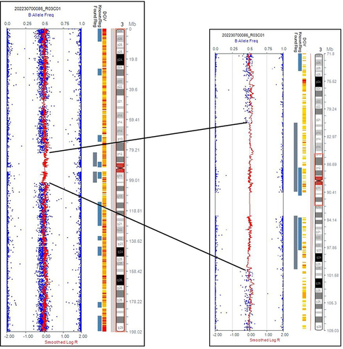 Figure 3 CMA testing result of Individual 1. A 24 Mb heterozygous deletion (LOH: loss of heterozygosity) in the 2p12.1p13.13 region was detected.