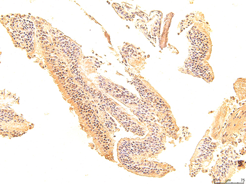 Figure 8 The immunohistochemical staining results of the day 7 group were observed under 200X microscope.