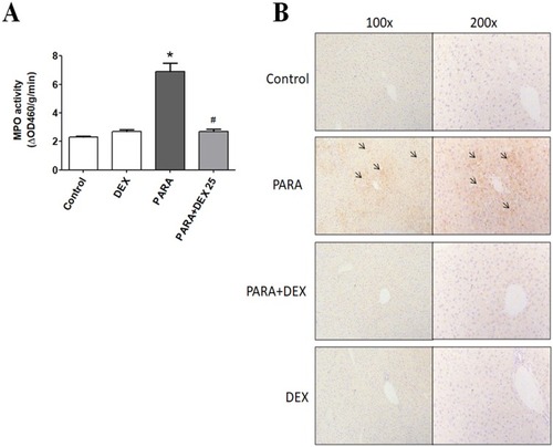 Figure 4 Effects of DEX treatment on hepatic MPO activity and immunohistochemical evidence of neutrophil accumulation following PARA-induced liver toxicity. (A) Mice were intraperitoneally administered PARA (300 mg/kg) alone or 25 μg/kg DEX 30 mins after injection of PARA and sacrificed 16 hrs later for the assessment of liver MPO activity. Results are presented as the mean ± SEM; n = 6 mice per group. *p < 0.05 vs control; #p < 0.05 vs PARA alone. (B) Mice were administered saline (control), PARA (300 mg/kg) alone, DEX (25 μg/kg) 30 mins after PARA injection, or DEX (25 μg/kg) alone, and were sacrificed 16 hrs later for immunohistochemical staining. Liver sections were immunostained for neutrophils (black arrows). Typical images were chosen from each group.