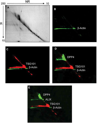 Figure 4. Diagonal SDS-polyacrylamide gel electrophoresis and western blot (WB) analyses of UEV recovered at 40,000 g. Thirty μg of protein was loaded in the first dimension. The gel was stained with colloidal Coomassie (A). Consecutive detection in WB of: (B) β-actin, (C) tumour susceptibility gene 101 (TSG101), (D) dipeptidyl dipeptidase 4 (DDP4); (E) programmed cell death 6-interacting protein (ALIX) in this chronological order. NR: non-reducing (-DTT), R: reducing (+DTT).