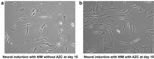 Figure 4. Morphological analysis of ADSCs after neural induction with and without 5-azacytidine (AZC) showed differences in differentiation pattern. At d 15 after neural induction with NIM without AZC, differentiating cells display networks resembling neural circuits (a). Non-differentiating cells at d 15 after neural induction with NIM and AZC display less differentiation (b). (Magnification10x).