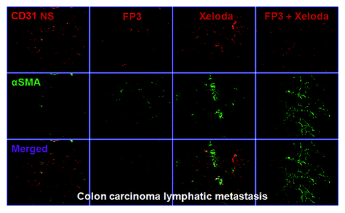 Figure 4. FP3 and capecitabine (Xeloda) decreased vascular structure in the xenograft model of colon carcinoma lymphatic metastasis. Vasculature was examined by angiography with immunostaining for endothelial cells (using anti-CD31 antibody; bar = 100 μm) and pericytes (using anti-α-sMa antibody; bar = 100 μm)