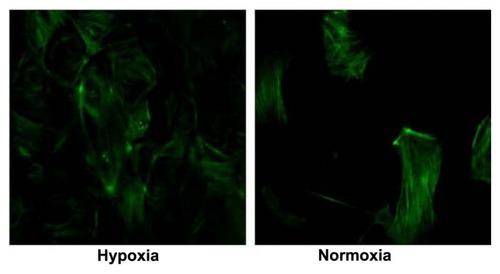 Figure 2 Phalloidin staining to evaluate podocyte actin framework under hypoxia and normoxia culture conditions (20×).