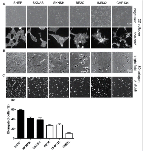 Figure 2. Morphology of single neuroblastoma cells in 2D versus 3D collagen environments. (A) Representative images of the indicated cell lines grown on collagen coated coverslips (2D). Shown are bright-field images (top panels) and cells fixed and stained with fluorescently-tagged phalloidin (bottom panels). (B) Bright-field images of single cell suspensions in 3D collagen. (C) Phalloidin-stained cells in 3D collagen gels. Histogram below shows the percentages of elongated cells for each cell line, data for cells lacking MYCN amplification represented in the black bars and MYCN amplified in the white bars.