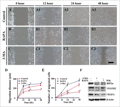 Figure 7. The exposure of 3-MA suppresses, but RAPA does not affect HUVECs cell migration in scratch test. (A-C) The representative images of HUVECs scratch test at 0-hour incubation from control (A), 3-MA-treated (B) and RAPA-treated (C) groups respectively. (A1-C1, A2-C2, A3-C3) The representative images of HUVECs scratch test at 12-h (A1-C1), 24-h (A2-C2) and 48-h (A3-B3) incubation from control (A1-A3), 3-MA-treated (B1-B3) and RAPA-treated (C1-C3) groups respectively. (D) The graph showing the distances of HUVEC cell migration along with incubation time in presence/absence of RAPA or 3-MA. (E) The graph showing the alteration of migrated HUVECs cell numbers along with incubation time in presence/absence of RAPA or 3-MA. (F) Western blot data showing the expressions of HIF 2α, VEGFR2 and VEGFA following the treatments of RAPA and 3-MA. Scale bars = 100 µm in A-C, A1-C1, A2-C2, A3-C3 and 100 µm in A4-C4.
