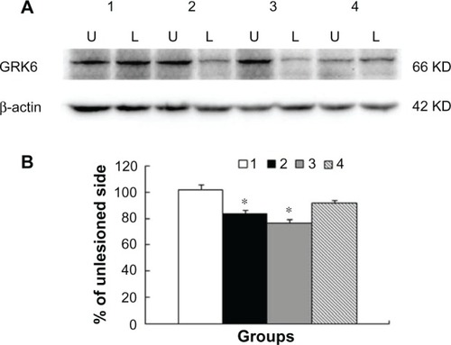 Figure 3 Changes in GRK6 protein expression in rat striatum. Rats were subject to sham surgery (group 1), 6-OHDA lesions (group 2), 6-OHDA lesions followed by 23 daily treatments with levodopa (group 3), and coadministration of MK-801 and levodopa on the last day (group 4). GRK6 protein levels in the striatum on both the lesioned (L) and nonlesioned (U) sides were assayed by Western blotting. Representative immunoblots (A) are shown above the quantification of data (B).