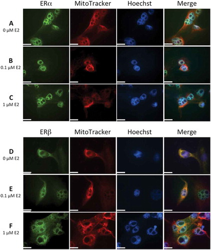 Figure 6. Immunolocalization of estrogen receptors, ERα and ERβ, in human lens epithelial cells (HLECs) after exposure to 17β-estradiol (E2) for 1.5 h.Nuclear morphology is shown with Hoechst 33342, and MitoTracker Deep Red FM was used for mitochondrial localization. Cells were also labeled with antibodies against ERα and ERβ and visualized by Alexa Fluor 488. Images show ERα (A, B, C) and ERβ (D, E, F) localization in nucleus. Mitochondrial localization of ERβ is evident by the colocalization with MitoTracker, showing a more intense yellow color in merged images (D, E, F) compared to no colocaliztion with ERα (A,B,C). The immunolabeling of ERβ increased slightly at the highest E2 concentration, 1 µM (F). Original magnification: 1000×. Scale bar: 20 µm.