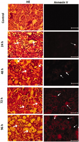 Figure 4. Temporal evaluation of the morphological changes in the HgCl2-associated acute kidney injury. The arrows show in HE stain photomicrographs the cellular atrophy of distal and proximal tubules, distortion of cellular continuity, nucleus loss, and hyperchromatic nuclei. Meanwhile, the annexin V positive cells are observed in red.
