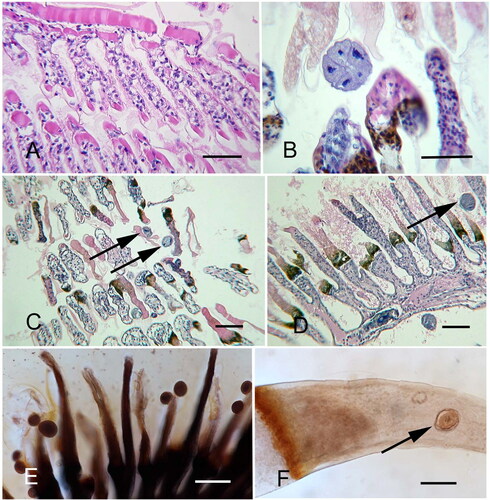 Figure 15. Light microscopy of Litopenaeus setiferus gills with Hyalophysa lynni infection. A. Low magnification of gills with no infection. B. H. lynni cyst with multiple tomites. Adjacent lamellae have undergone melanization and necrosis of the distal regions. C-D. Heavily infected gill regions with melanized areas (brown) and attached ciliates (arrows). E. Unsectioned area of gills with attached spherical ciliate cysts. F. Single gill lamella with melanization area (left) and a cyst scar from a previously attached ciliate (arrow). A-D. H & E. E-F. Silver nitrate. Scale bars 50 µm (A-D, F), 100 µm (E). Figure E used with permission from Landers et al. (Citation2020). Remaining figures are new.