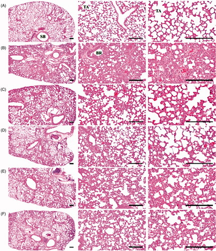 Figure 4. Mucous secretions during the expectorant assay. Values are expressed as means ± SD of eight mice. KOG: Kyeongok-go, Traditional mixed herbal formulation. AM: Ambroxol; OD: Optical density; TLF: Trachea lavage fluid. F-value = 14.45. ap < 0.01 as compared with intact control by LSD test.