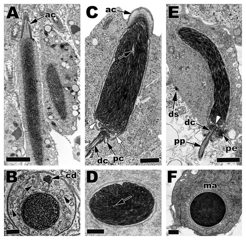 Figure 20 Light (Ground Skink step 5) and electron microscopy of mid-elongation in the American Alligator (Alligator mississippiensis) and the Ground Skink (Scincella lateralis) from the seminiferous epithelium. Acrosome, black arrows; acrosome granule, black arrowhead; nucleus, nu; chromatoid body, cd; endonuclear canal, white arrowheads; manchette, ma. Light: Bar = 15 µm, TEM: Bar = 5 µm.