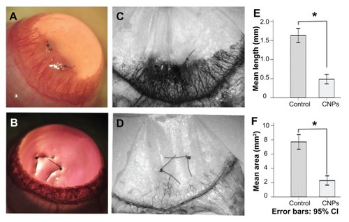 Figure 5 Inhibitory effects of celastrol nanoparticles on suture-induced corneal neovascularization in rats. Animals were sutured (two stitches) in the temporal cornea, and then treated with subconjunctival injection of celastrol nanoparticles (0.544 mg per rat) on day 0 and day 3 after surgery. Slit-lamp microphotographs of corneas were taken after mydriasis on day 6 after surgery. The pictures show (A) an intensive corneal neovascularization in response to suturing and (B) a marked inhibition of neovascularization by celastrol nanoparticles. The images were taken by perfusing the cornea with India ink on day 6 after suturing. Note the distinct suppression of corneal neovascularization by celastrol nanoparticles. (C) Abundant corneal neovascularization reached the sutures. (D) Shorter and fewer areas of corneal neovascularization were found in the celastrol-treated group. (E and F) show the inhibition effect of celastrol nanoparticles on the length and area of corneal neovascularization, respectively.Notes: The length and area of corneal neovascularization were measured with Image-Pro® Plus 5.1 (Media Cybernetics Inc, Bethesda, MD) in triplicate for each cornea. The data are presented as mean ± standard deviation of five rats. *P < 0.001 versus the control group (magnification: ×25).Abbreviations: CI, confidence interval; CNPs, celastrol nanoparticles.