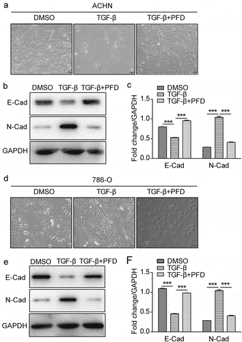 Figure 6. PFD suppresses TGF-β-induced EMT in renal cancer cells.
