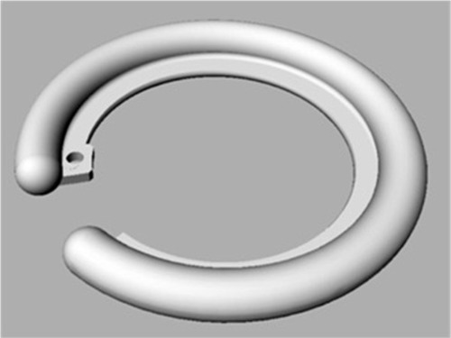 Figure 1 The design of the thick endocapsular open ring.
