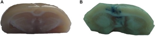 Figure 5 Microphotographs of Evans blue staining in rat brains to monitor the extent of blood–brain barrier disruption in rats following treatment with methotrexate-liposome-coupled microbubbles and ultrasound.Notes: (A) Rats receiving Evans blue injection only. (B) Rats treated with methotrexate-methotrexate-liposome-coupled microbubbles and ultrasound under the conditions shown for group 5 in Table 1.