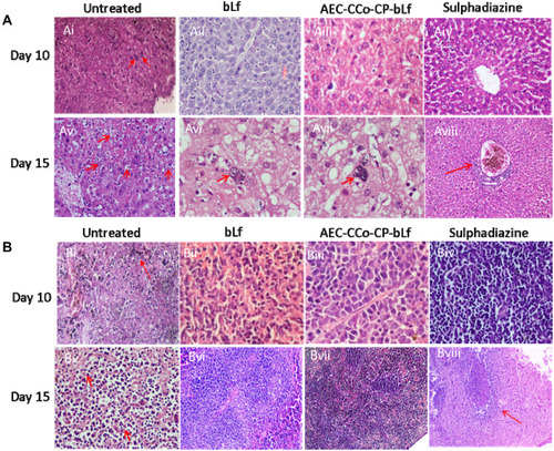 Figure 2 Histopathological analysis in liver (A) and spleen (B) at day 10 and 15 post infection.Notes: (Ai) Liver histopathology of untreated group of mice at day 10 post infection showing the presence of tachyzoites (marked with red arrows). (Aii–iv) Liver histopathology of treatment groups showing no sign of inflammation or parasite at day 10 post infection. (Av) Untreated control group showing huge number of infected macrophages marked by red arrows. (Avi–vii) bLf and NCs treatment groups showing development of bradyzoites or tissue cyst inside the macrophages (Kupffer cells) marked by red arrows. (Aviii) Sulphadiazine treatment group showing no infection but sign of inflammation marked by red arrow. (Bi) Untreated Spleen cells showing site of tachyzoite multiplication (red arrow). (Bii–iv) Treatment groups showing no sign of inflammation or infection. (Bv) Spleen histopathology at day 15 post infection showing multiple sites (50%) with tachyzoites marked with red arrows. (Bvi–vii) No parasite infection shown in treatment groups, however, inflammation and reactive spleen was seen in sulphadiazine group (Bviii) marked as red arrow.Abbreviations: AEC-CCo-CP-bLf, alginate chitosan calcium phosphate bovine lactoferrin; bLf, bovine lactoferrin.