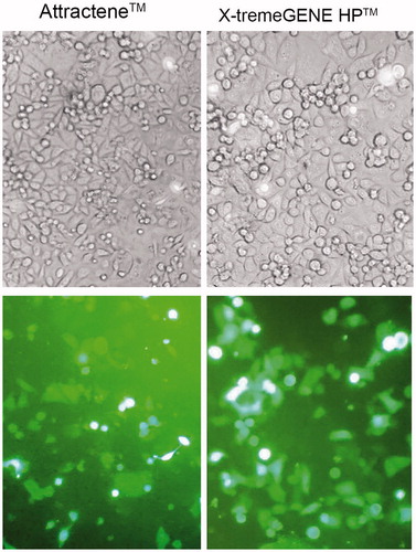 Figure 3. Fluorescence microscopic imaging of EGFP-transfected AGS cells. Transfection efficiency of the optimal transfection conditions for Attractene™ and X-tremeGENE HP™ reagents was studied under fluorescence microscopy. Phase contrast (top panel) and fluorescence (bottom panel) micrographs at 20× magnification.