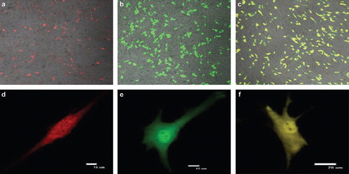 Figure 7. The comparative figures of three fluorescent proteins at 24 h after transfection using a confocal microscope (Nikon TE-2000-E, Japan) with excitation wavelengths of 433 nm-588 nm to determine the transfection efficiencies. (a,d), (b,e) and (c,f) were the transfection results of pDsRed1-N1, pEGFP-N3 and pEYFP-N1, respectively.