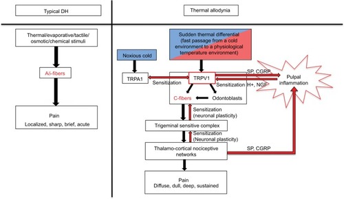 Figure 1 Hypothesis of possible mechanisms underlying dental thermal differential allodynia.