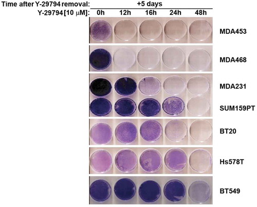 Figure 3. Y-29794 inhibits viability of triple-negative breast cancer cells