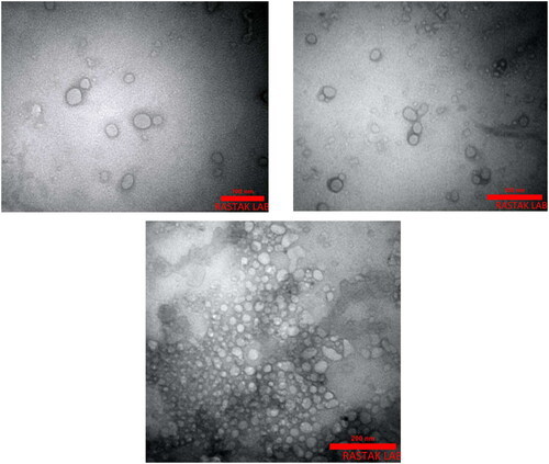 Figure 2. TEM image of MEL-loaded PEGylated nanoliposomes.
