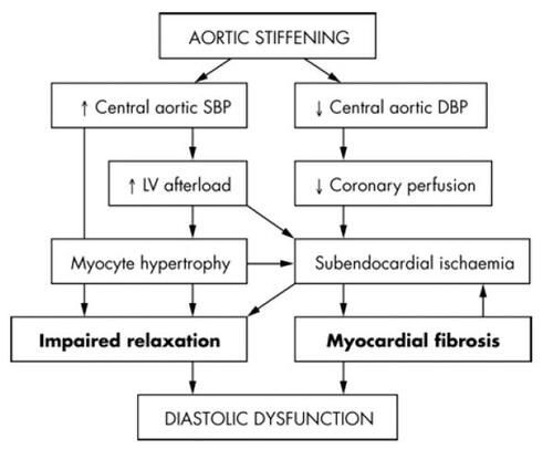 Figure 1 Pathophysiological pathways through which aortic stiffness may contribute to the development of diastolic dysfunction. DBP, diastolic blood pressure; SBP, systolic blood pressure. Reproduced with permission from CitationMottram PM, Haluska BA, Leano R et al 2005. Relation of arterial stiffness to diastolic dysfunction in hypertensive heart disease. Heart, 91:1551–6. Copyright © 2005. BMJ Publishing Group Ltd.