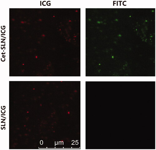 Figure 1. Successful conjugation of Cet to Cet-SLN. Scale bar: 25 μm.