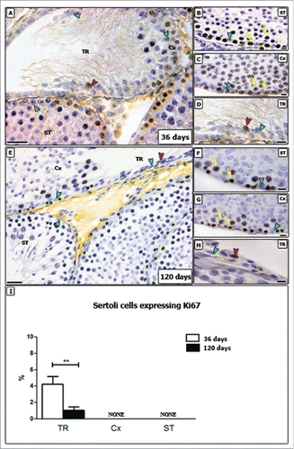 Figure 2. Ki-67 immunostaining in different testicular areas of pre-pubertal (A-D) and adult (E-H) Wistar rats. Images showing the seminiferous tubules (ST; B and F), the area adjacent to the transition region (Cx; C and G) and the transition region (TR; D and H). Positive and negative Sertoli cells are indicated respectively by red and green arrowheads. In TR, Sertoli cells were observed proliferating at 36 and 120 days. The number of proliferating Sertoli cells observed in adults (∼1%) are significantly lower than those found in pre-pubertal rats (∼4%) (p < 0.05) (I). As expected, proliferating germ cells were observed in the seminiferous epithelium (yellow arrows). Bar: 50 μm (A and E); 10 μm (B-D, F-H).
