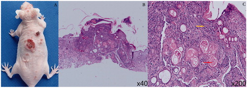 Figure 5. Cutaneous squamous cell carcinoma (cSCC) tumours in SKH-1 mice induced by ultraviolet (UV) irradiation. (A) Representative photograph of UV-treated SKH-1 hairless mice, inducing cSCC tumours with various sizes. The histological examination showed that a large number of atypical cells (yellow arrow), keratin pearl (red arrow) in the tissue at 40 × (B) and 200 × (C), which were the characteristic of cSCC tumours.