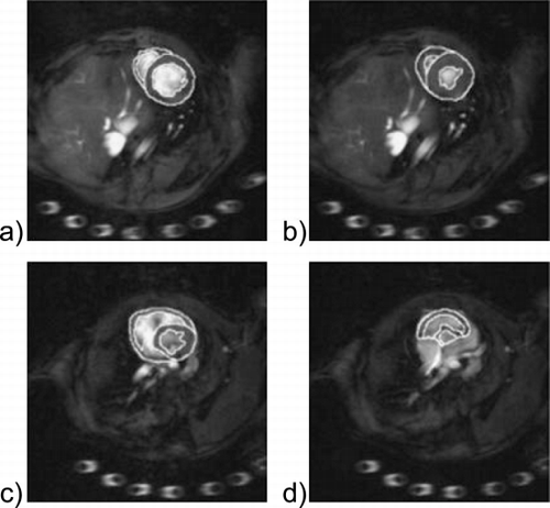 Figure 1. Delineation of epicardial and endocardial contours in both ventricles at diastole (a, c) and systole (b, d) in a mid‐ventricular (a, b) and basal plane (c, d).