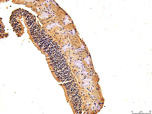 Figure 10 The immunohistochemical staining results of the day 21 group were observed under 200X microscope.