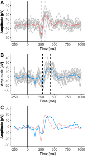 Figure 2 Representative examples of contact heat evoked potentials (CHEPs) of an individual with CRPS (red) and an age- and sex-matched HC (blue) stimulated in the painful area. Vertical dashed lines mark the N2- and P2-peak. (A) CHEPs (average and single trials) from a CRPS individual (f, 57y, tested area: hand). (B) CHEPs (average and single trials) from a HC individual (f, 52y, tested area: hand). (C) Overlay of the two averaged CHEPs from both individuals.