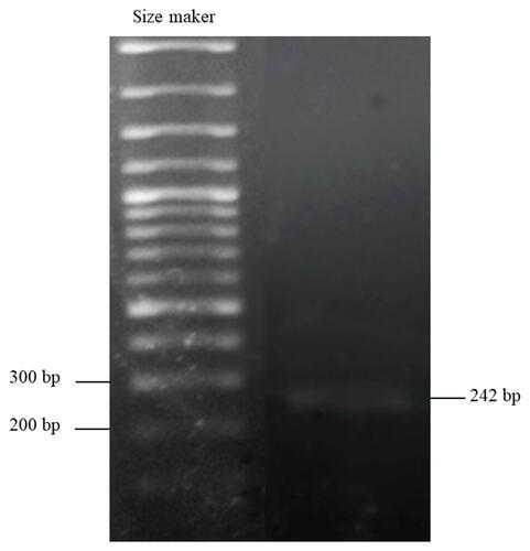 Figure 2 DNA amplification by PCR examined in primary porcine cardiomyocyte cell isolated from the right atrium (RA). Fragment of the expected size for MYBPC3 gene (242 base pairs) was amplified successfully in the sample.