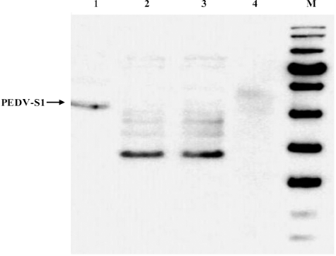 Figure 2. Expression of PEDV-S1 fusion protein. PEDV-S1 was expressed using standard expression parameters such as 1 mM IPTG, 37 °C pre- and post-induction temperatures and 3 h post-induction incubations. Overexpressed PEDV-S1 band was seen at expected size in the lane 1 while in the negative controls (lanes 2 and 3; uninduced culture and induced cells without plasmid, respectively) corresponding band was not present.